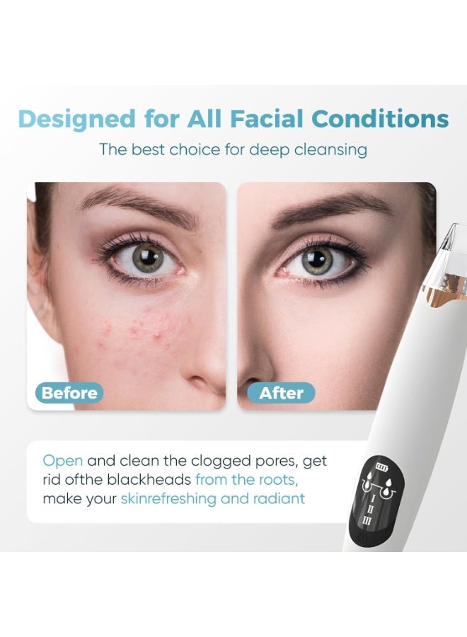 general Facial Pore Blackhead Remover Vacuum - Facial Pore Cleaner with 3 Adjustable Suction Levels, 3 Probes, USB Charging Interface - Blackhead Extractor Tools for Women & Men (White) - Image 2